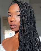 itchy scalp locs